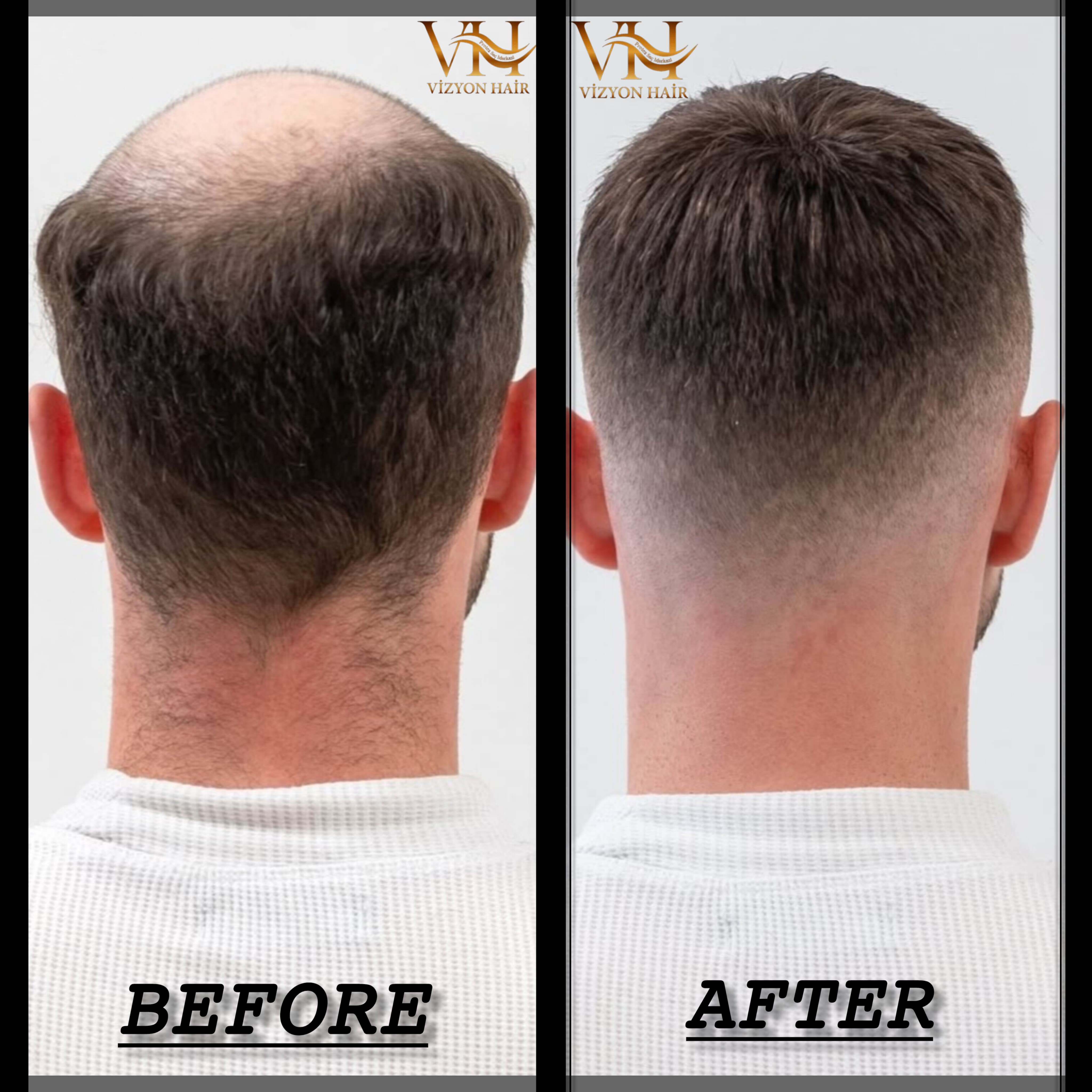 Uygulama öncesi görünüm